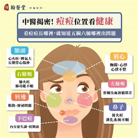 額頭代表什麼|額頭長痘痘代表什麼？痘痘肌的「7個日常保養守則」少吃乳製品。